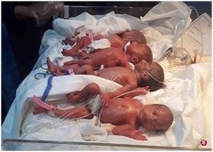 伊拉克一女子顺产七胞胎 系该国首例